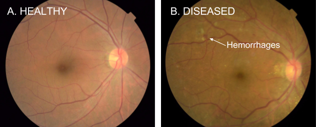 image from What Healthcare AI startups should learn about releasing AI solutions for real-life clinical use